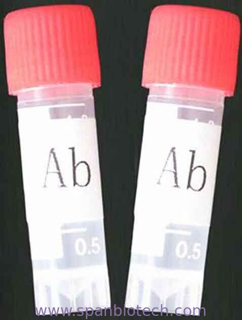 Monoclonal Antibody to Amphetamine(AMP)